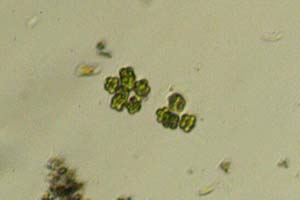 Chlorophyte dividing?