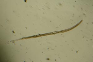 Spirostomum