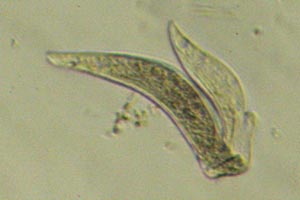 Ciliate