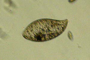 Ciliate