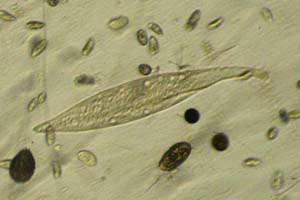 Amphileptus, colepids