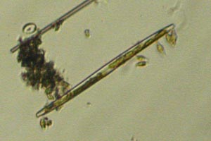 Diatom
