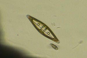 Diatom