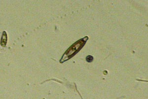Diatom