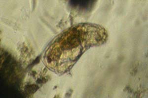 Cephalodella cf catellina