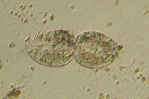 Spirotrich dividing