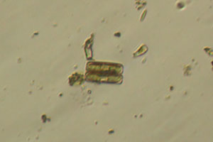 Diatom