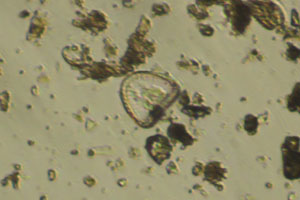 Diatom