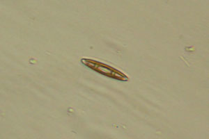 Diatom