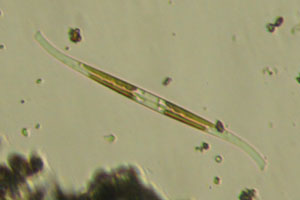 Diatom