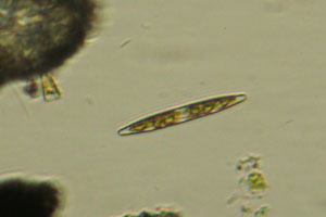 Diatom