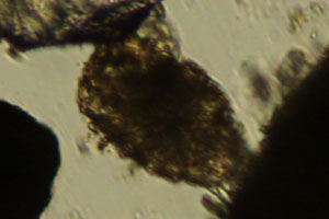 Rotifer