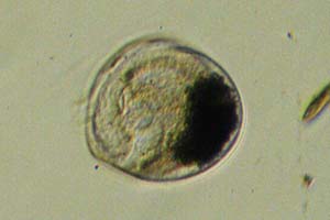 Ciliate