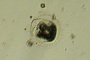 Ciliate