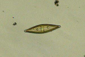 Diatom