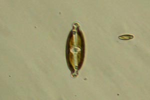 Diatom