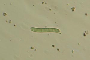 Cyanobacteria