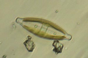 Diatom