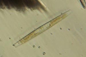 Diatom