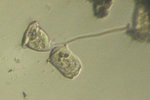 Vorticellid dividing
