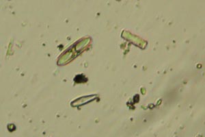 Diatoms