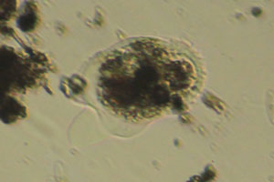 Amoebozoa