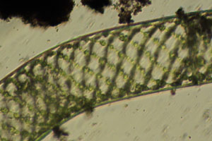 Spirogyra