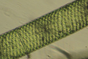 Spirogyra