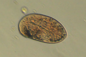Ciliate
