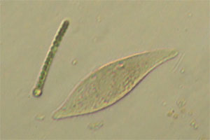 Litostome