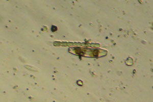 Diatom