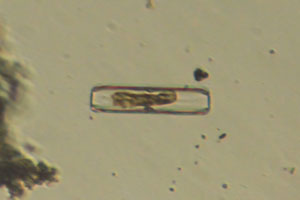 Diatom