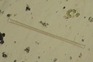 Diatoms