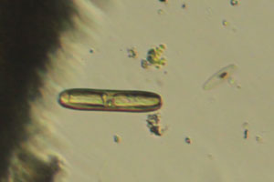Diatoms