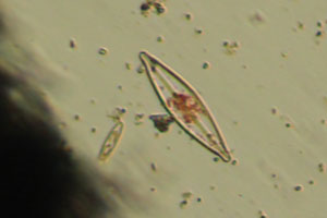 Diatoms