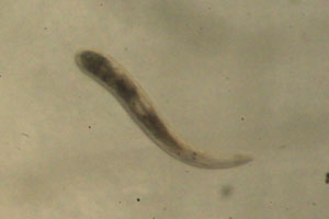 Gyratrix hermaphroditus