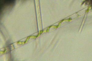 Spirogyra