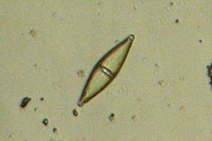 Diatom