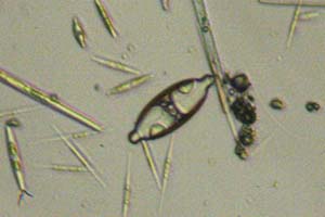 Diatom