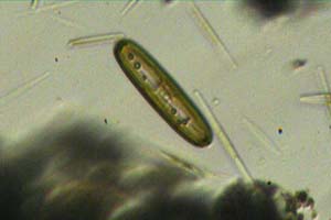 Diatom