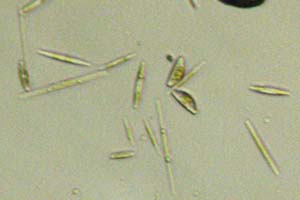 Diatoms