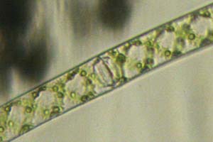 Spirogyra