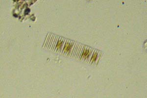 Diatoms