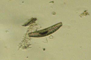 Diatom