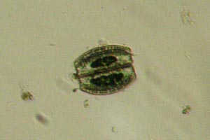 Diatoms