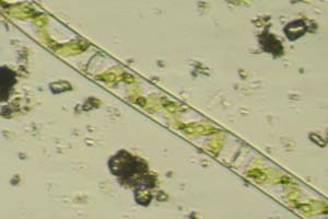 Spirogyra