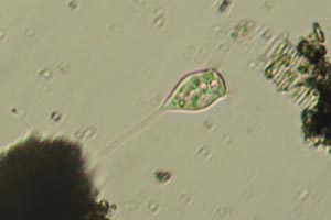 Vorticella