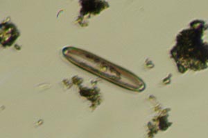 Diatom