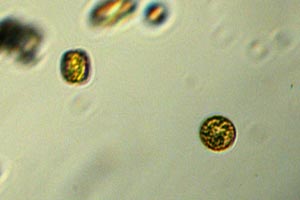 Diatoms
