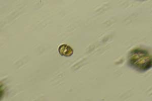 Dinoflagellate